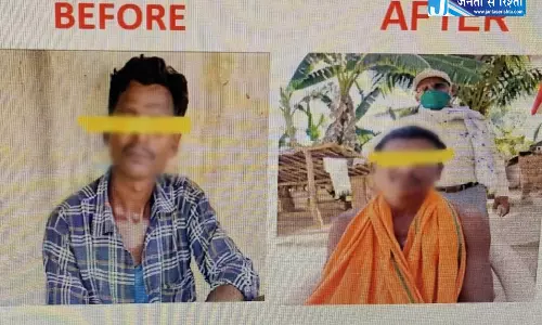 कुष्ठ रोग का समय पर इलाज से सामान्य जीवन जी रहे